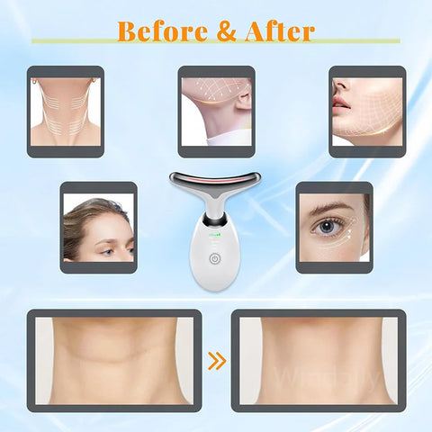 LED Face Lifting Device