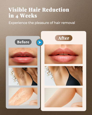 IPL Laser Hair Remover